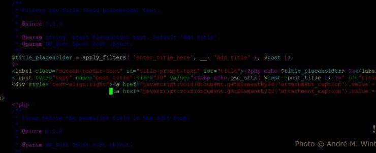 Why Basketball: A Game of Fitness and Teamwork in Perfect Harmony